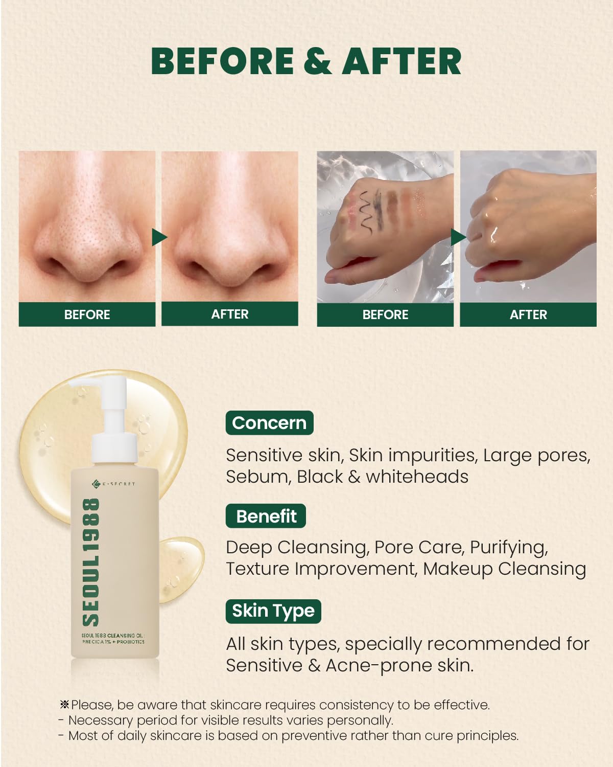 KSECRET Seoul 1988 Cleansing Oil: Pine Cica 1% + Probiotics 200ml - H ART