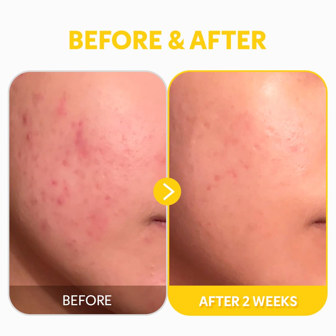 TIRTIR Pure Vitamin C 24% Serum 30ml - H ART