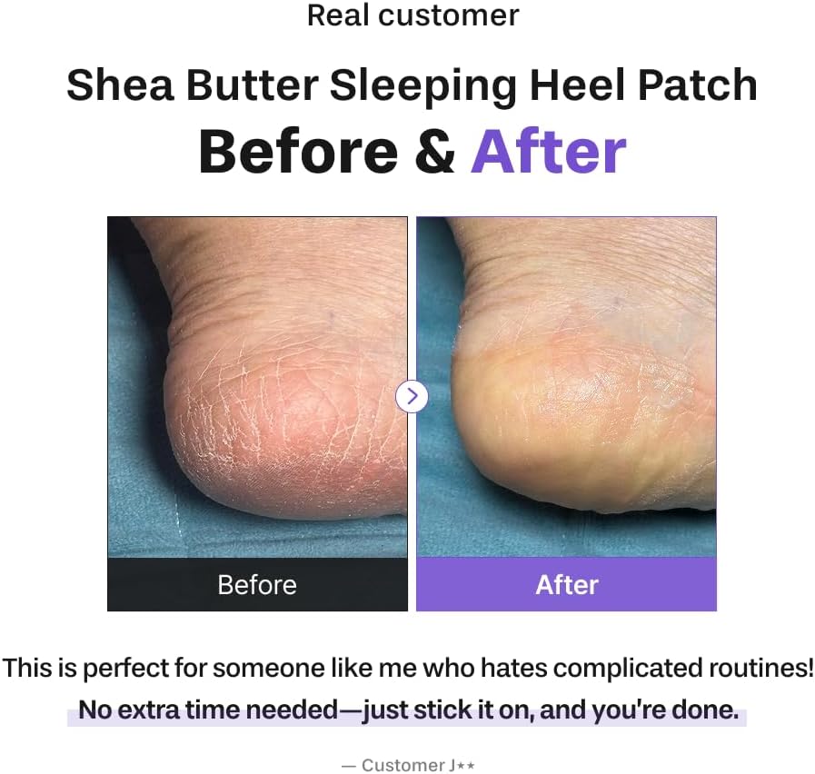 Baren Shea Butter Sleeping Heel Patch 10EA