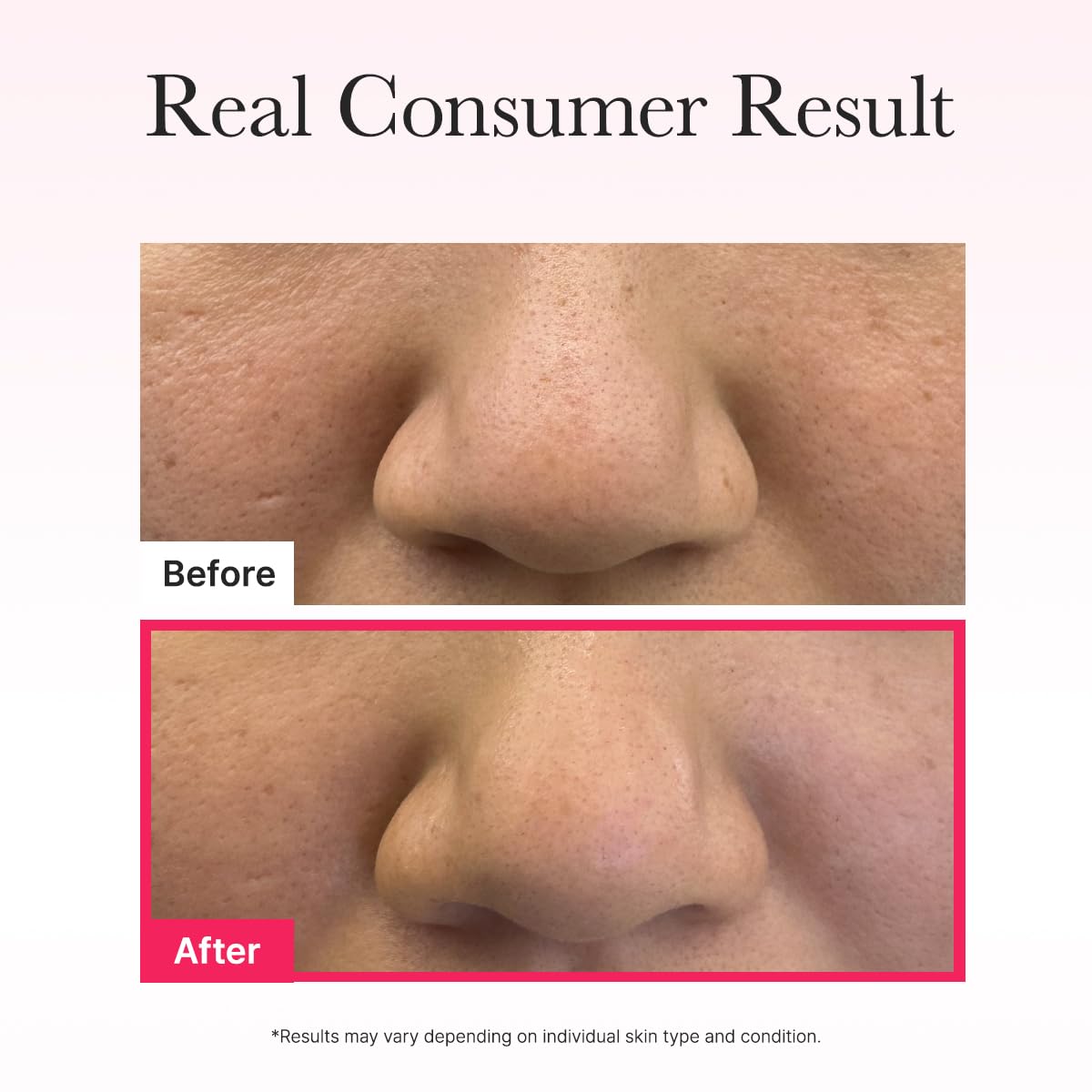 ARENCIA Red Collagen Jello Mask 1EA