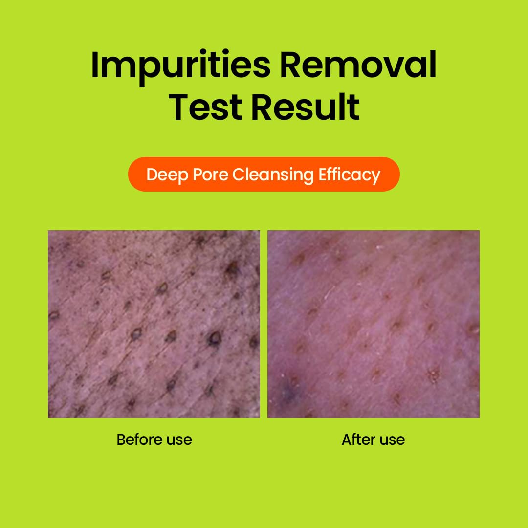 beplain Mung Bean Cleansing Foam 80ml - H ART