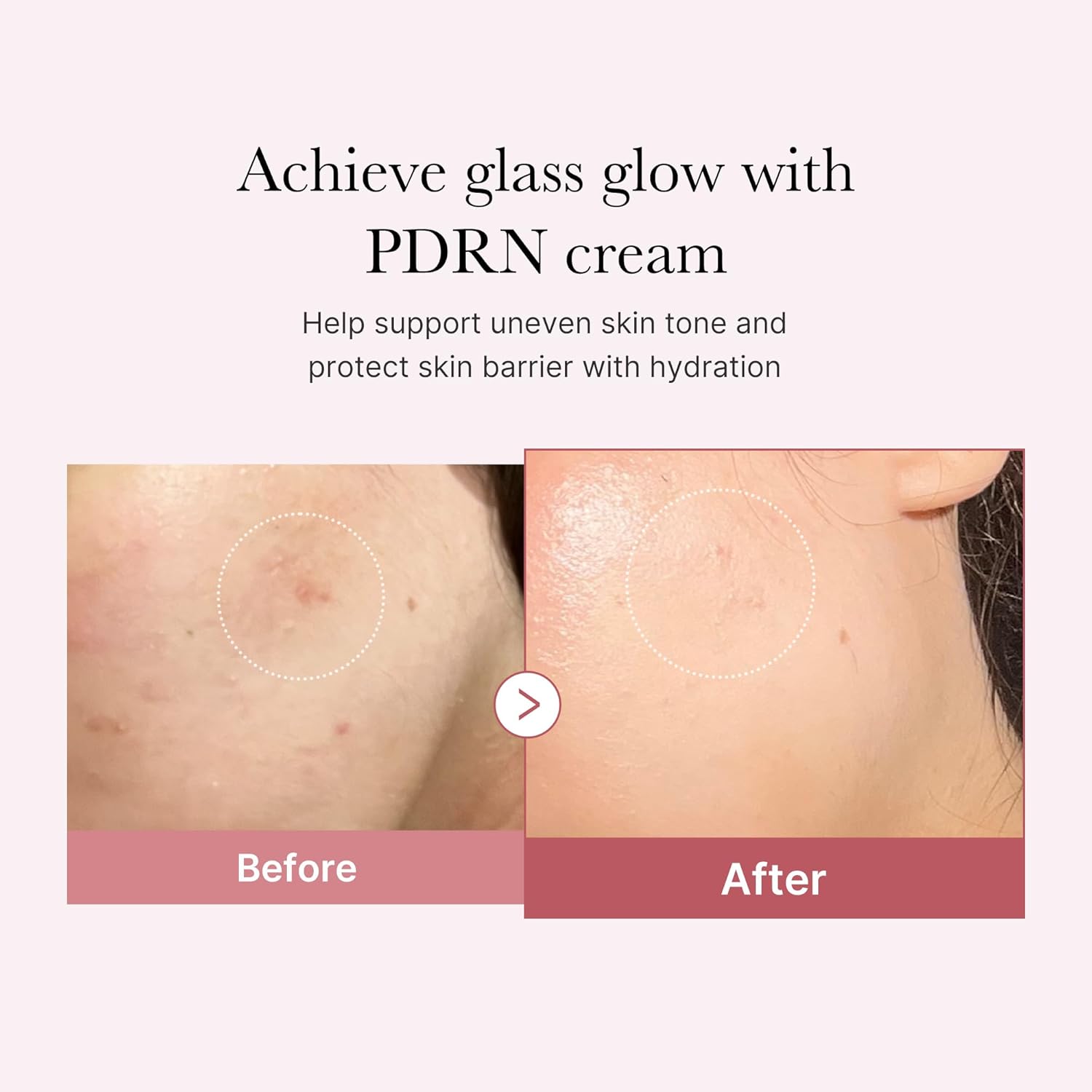 Medicube PDRN Pink Hyaluronic Moisturizing Cream 50mL