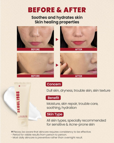 KSECRET Seoul 1988 Cream: Snail Mucin 93% + Rice 100ml - H ART