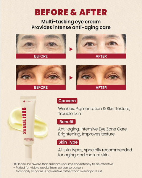KSECRET Seoul 1988 Eye Cream: Retinal Liposome 4% + Fermented Bean 30ml