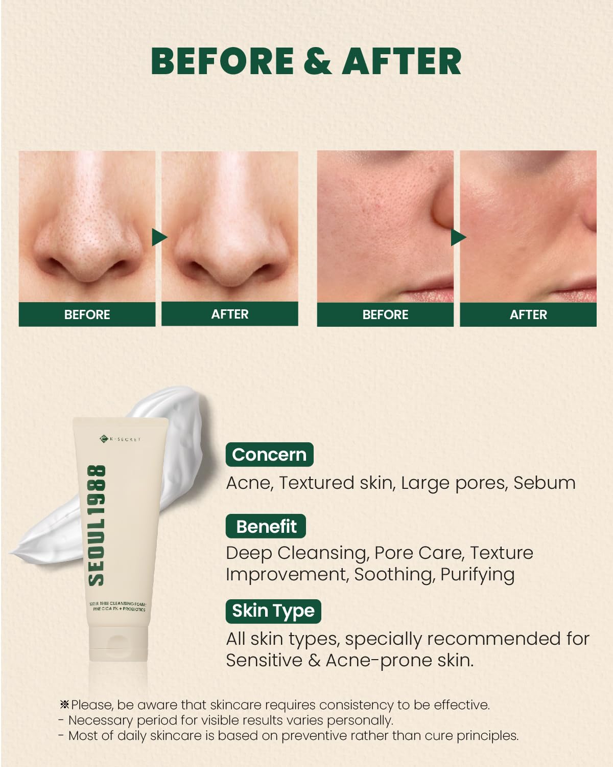 KSECRET Seoul 1988 Cleansing Foam: Pine Cica 1% + Probiotics 150ml - H ART