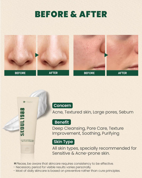 KSECRET Seoul 1988 Cleansing Foam: Pine Cica 1% + Probiotics 150ml - H ART