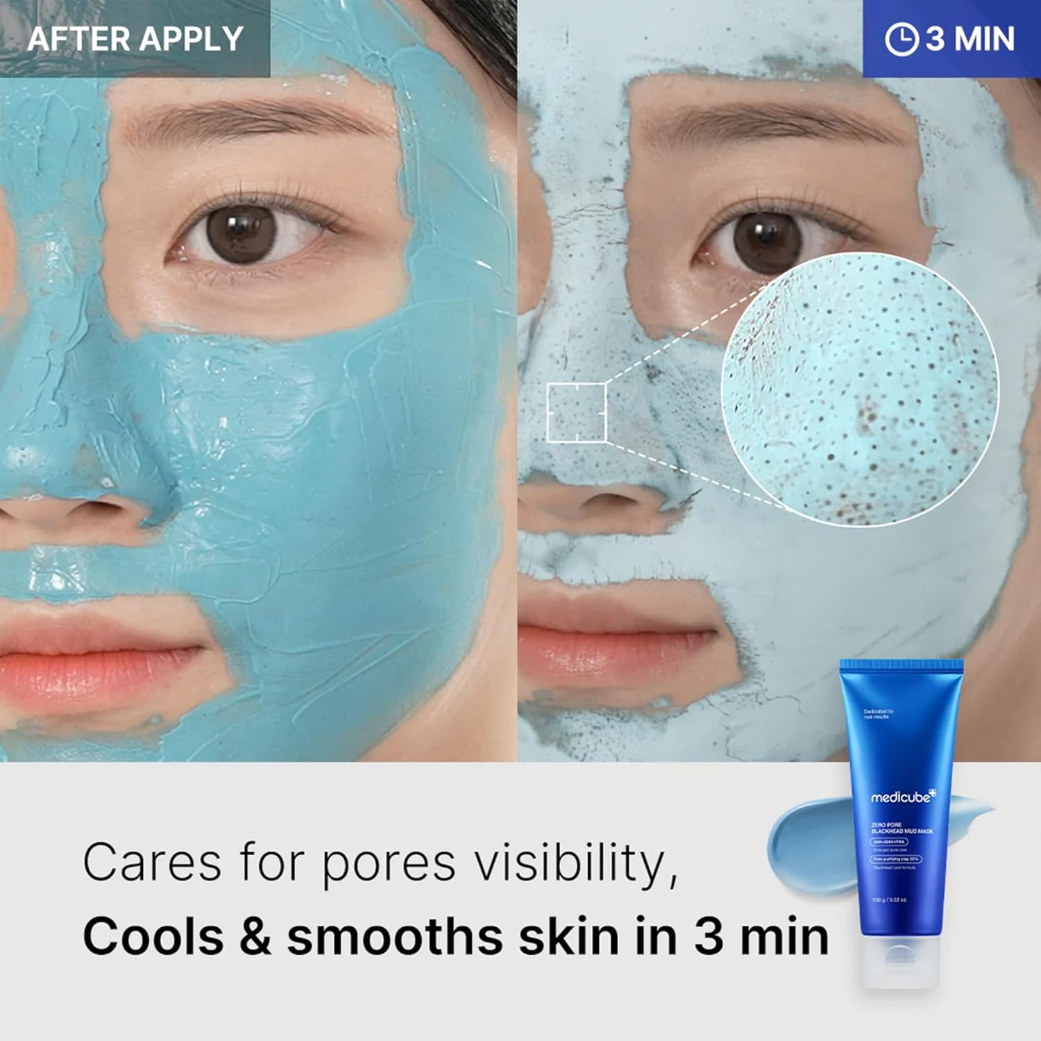 Medicube Zero Pore Blackhead Mud Mask 100g - H ART