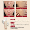 KSECRET Seoul 1988 Essence: Snail Mucin 97% + Rice 100ml - H ART