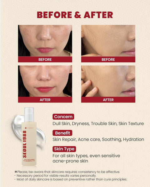 KSECRET Seoul 1988 Essence: Snail Mucin 97% + Rice 100ml - H ART