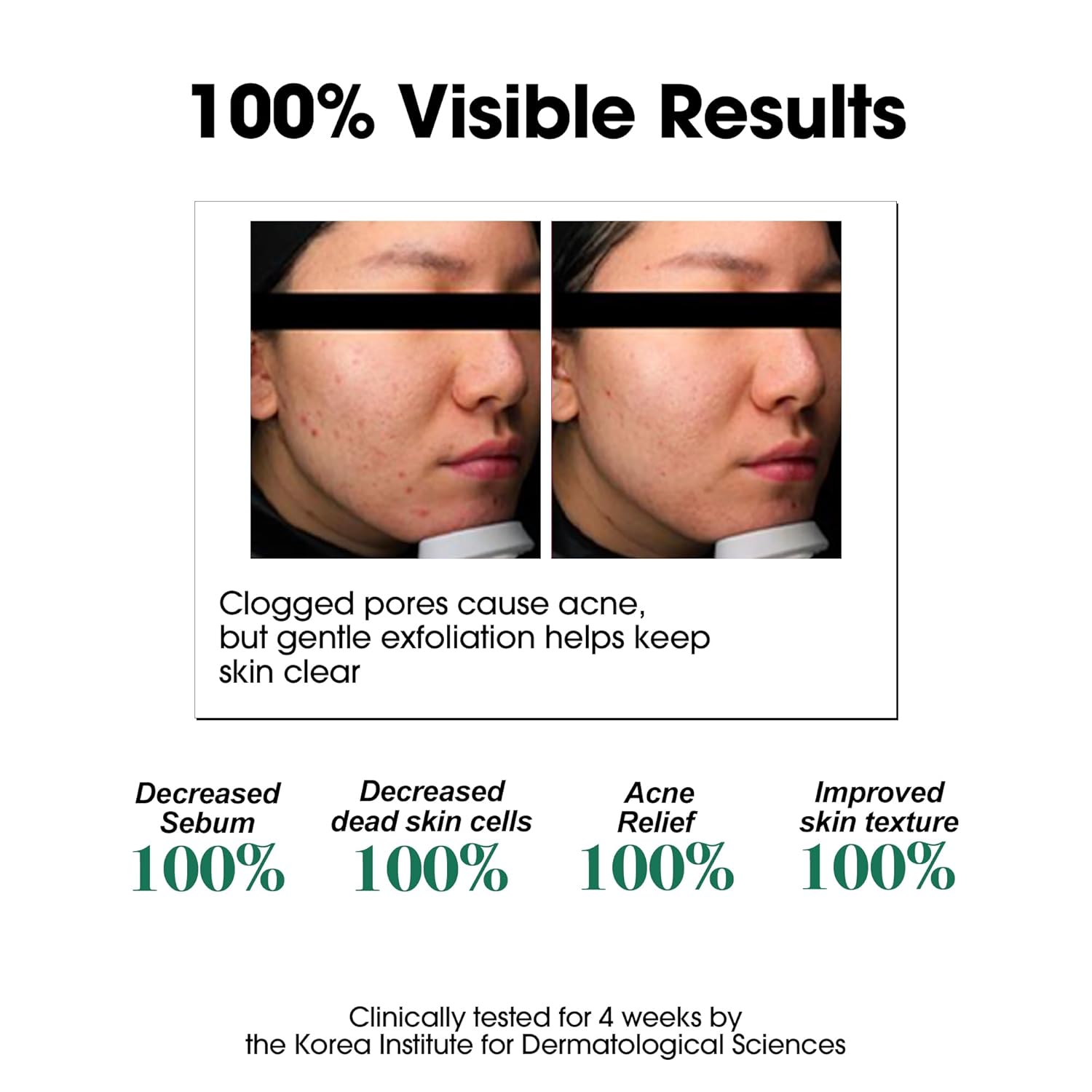 SOME BY MI AHA BHA PHA 30 Days Miracle Toner