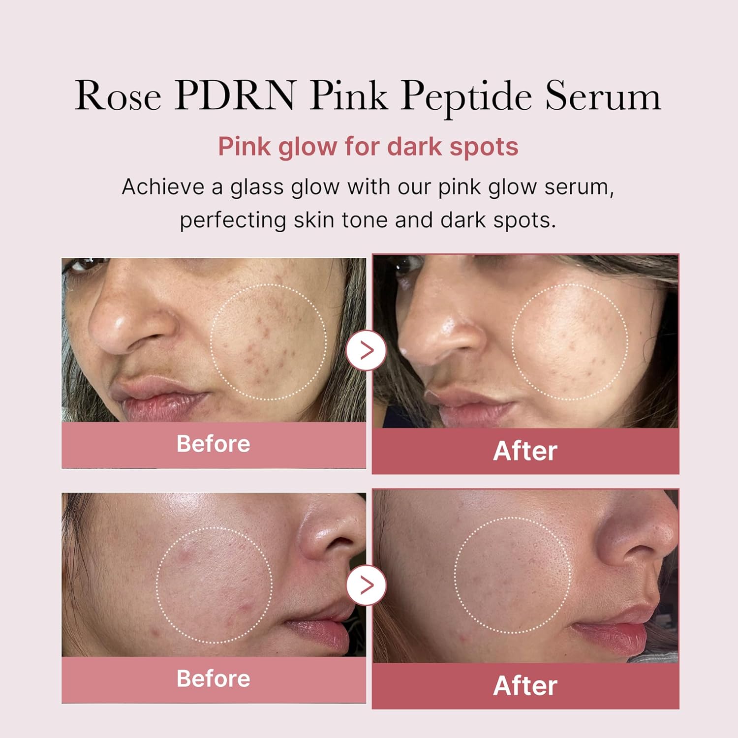 Medicube PDRN Pink Peptide Serum 30ml - H ART