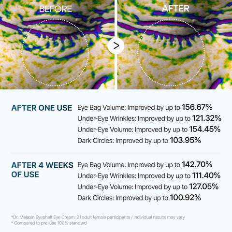 Dr.Melaxin Eyephalt Eyecream for Eyebags 10ml