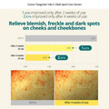 goodal Green Tangerine Vita C Dark Spot Care Serum 40ml - H ART