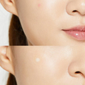 COSRX Acne Pimple Master Patch - H ART