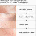 ANUA Nano Retinol 0.3% Nicain Renewing Serum 30ml - H ART