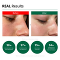 Dr.G Red Blemish Clear Sooth Cream 70ml - H ART