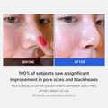 Medicube Zero Pore Pad 2.0 70 Pads - H ART