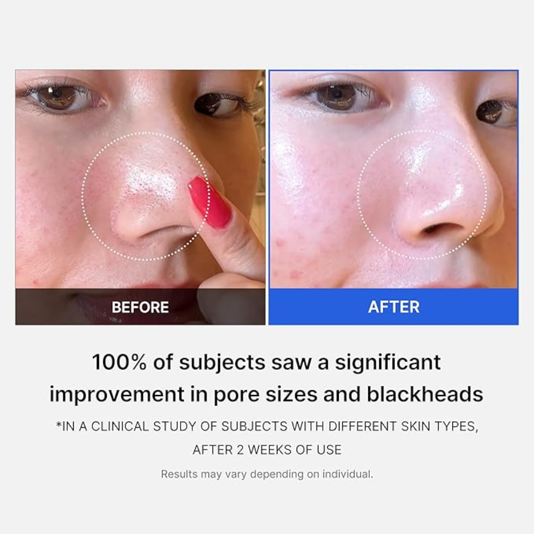 Medicube Zero Pore Pad 2.0 70 Pads - H ART