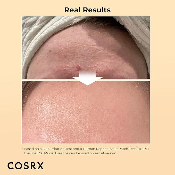 COSRX Advanced Snail 96 Mucin Power Essence 100ml - H ART